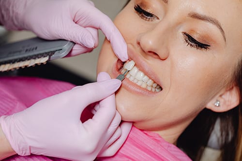 Dental Veneers in Cleveland, TN | Center for Cosmetic Dentistry