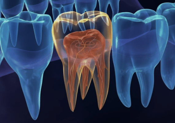 Root Canal Therapy in Cleveland, TN | Pain Relief | Endodontics