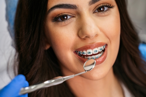 Traditional Braces in Cleveland, TN | Orthodontic Treatment