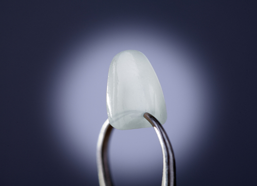 Lumineers Dentist in Cleveland, TN | Learn About No-Prep Veneers
