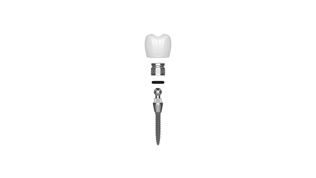 Mini Implant in Cleveland TN | Call for a Free Consultation!