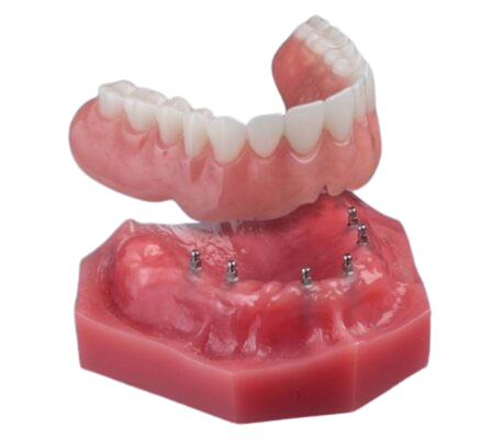 Snap In Dentures in Cleveland, TN | Book a Free Consultation