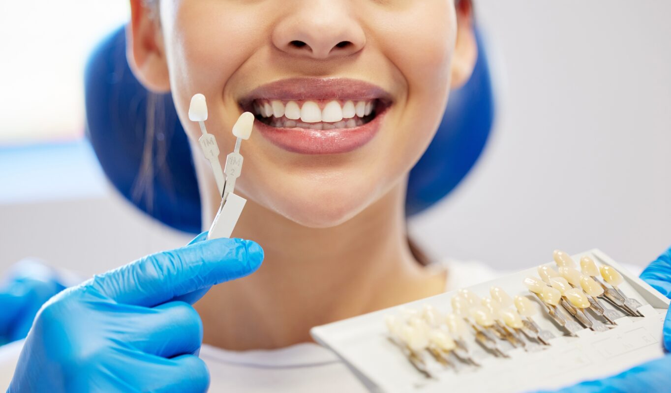 Types of Veneers in Cleveland, TN | Call for a free consultation!