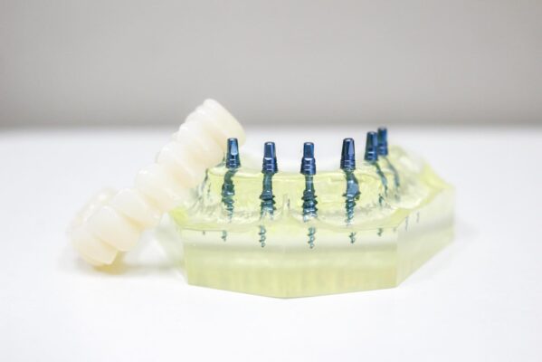 Mono Dental Implants in Cleveland, TN | Dentures That Stay Put!