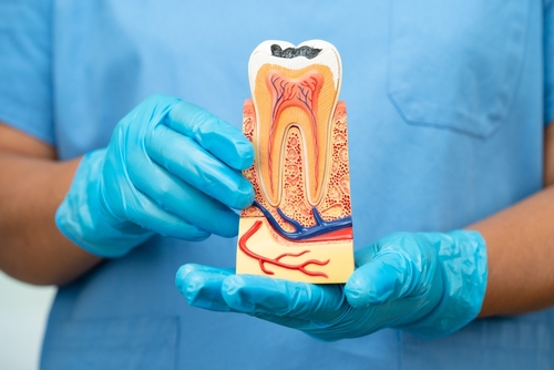 Root Canals in Cleveland, TN | Save Your Tooth From Extraction!