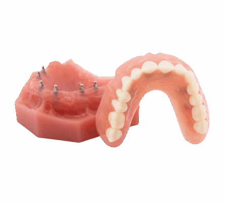 Denture Options in Cleveland, TN | Book a Free Consultation Today