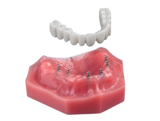 Loose Dentures in Cleveland, TN | Book a Free Consultation Today