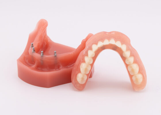 Implant Retained Dentures in Cleveland, TN | Free Consultations!