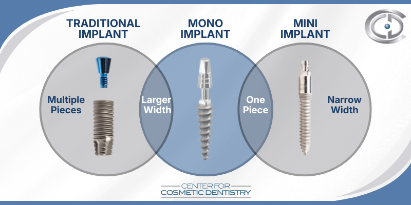 Dental Implant Types in Cleveland, TN | Mini Implants, Mono Implants, and Conventional Implants