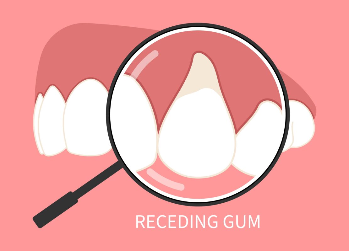 Periodontal Disease in Cleveland, TN | Free Cosmetic Consultation