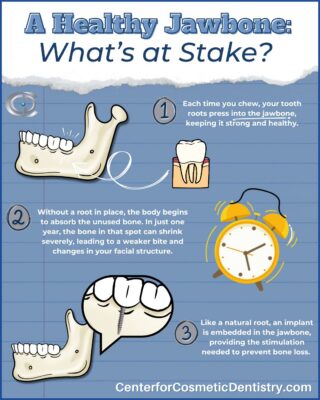 Bone Loss in Cleveland, TN | Free Consultation